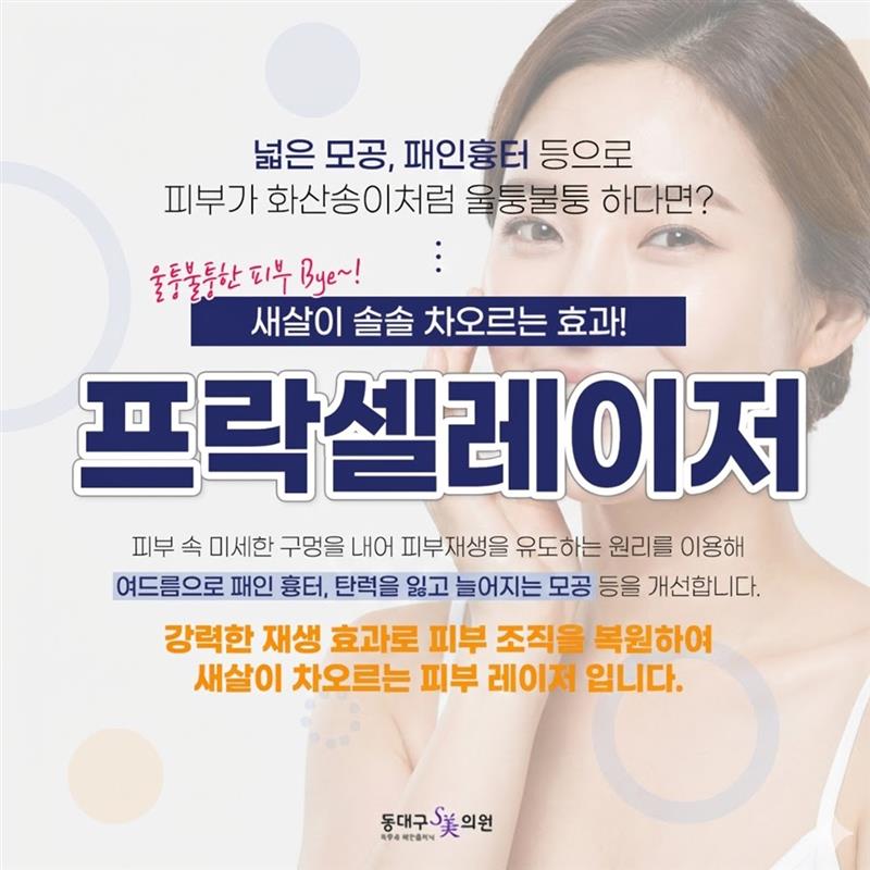 프락셀레이저